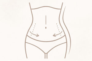 after tummy tuck pic