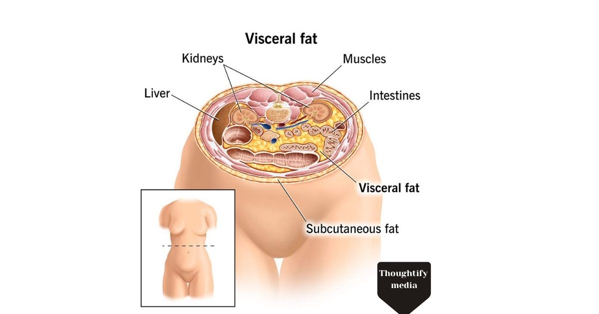 body-structure-for-visceral-fat-surgery-information